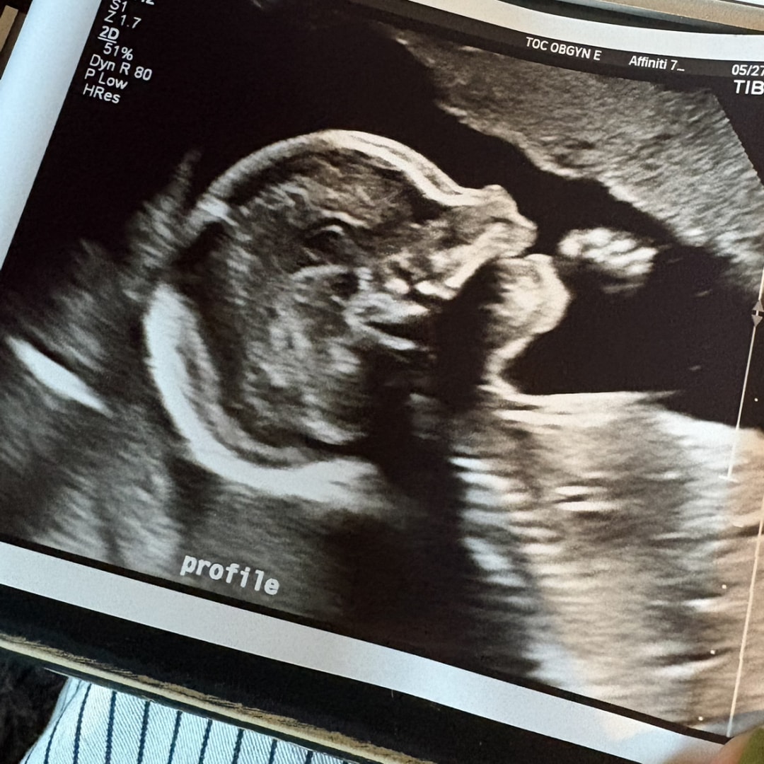 Photo shared by Baylie for their Babylist baby registry.