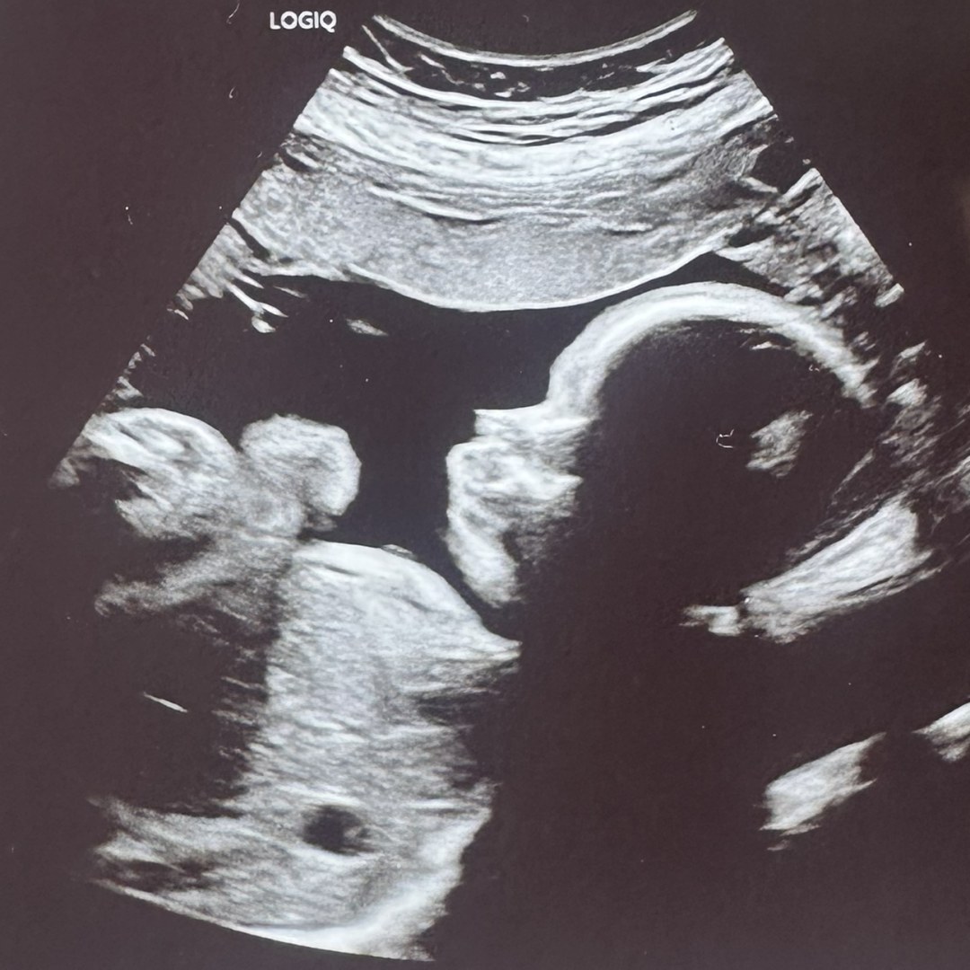 Photo shared by Makayla for their Babylist baby registry.