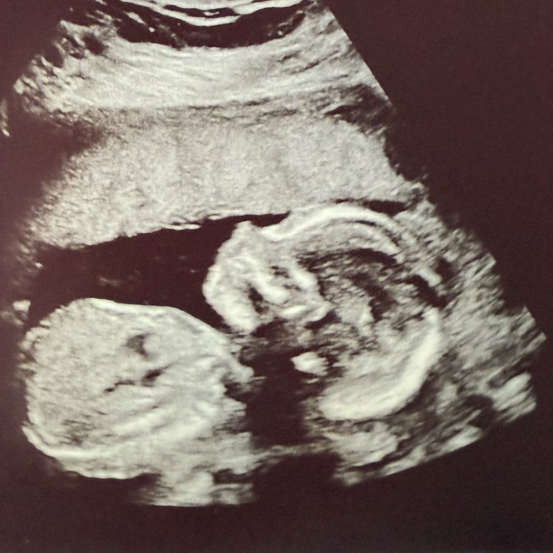 Photo shared by Leslie for their Babylist baby registry.