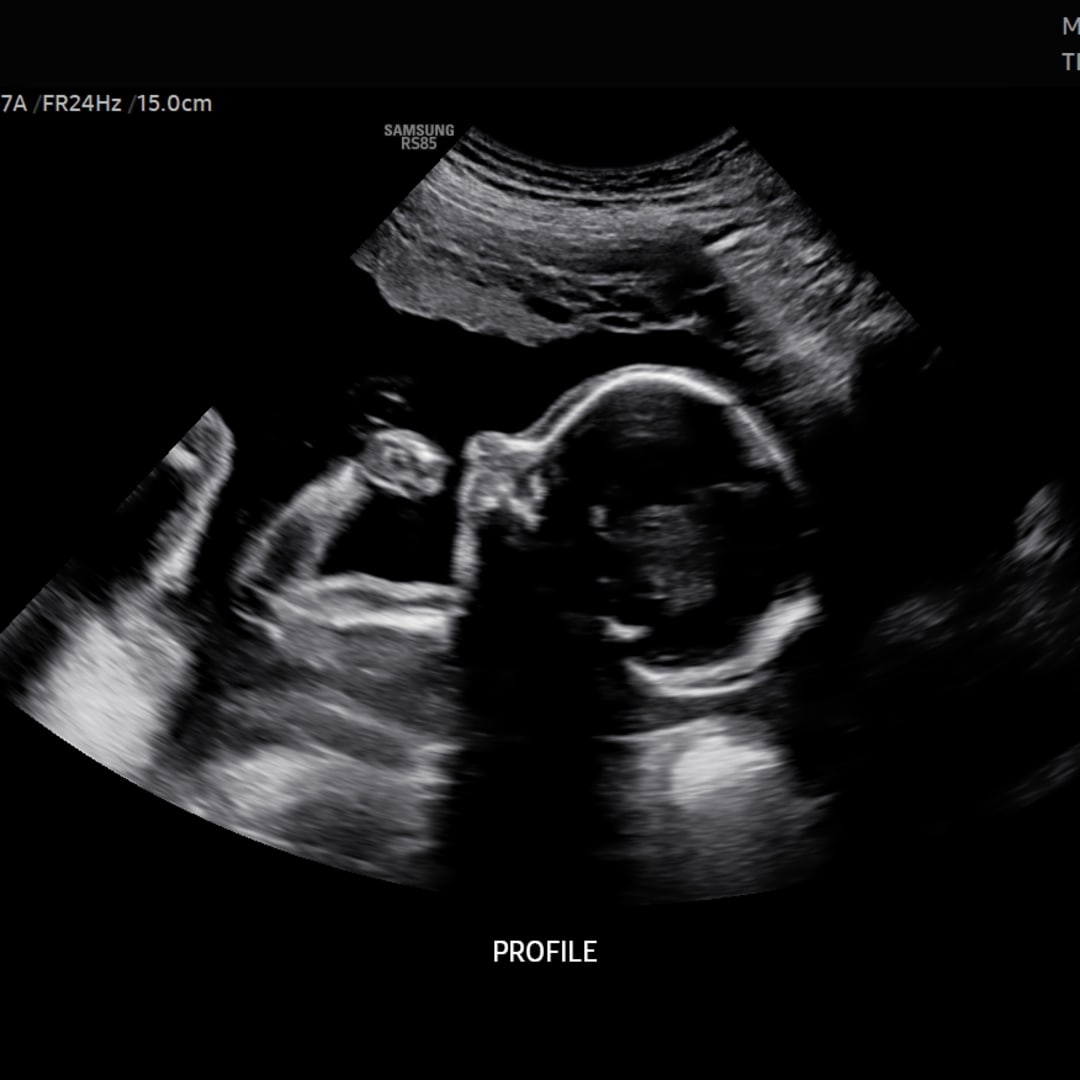 Photo shared by Elizabeth for their Babylist baby registry.