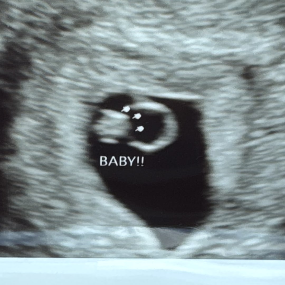 Photo shared by Aymie for their Babylist baby registry.