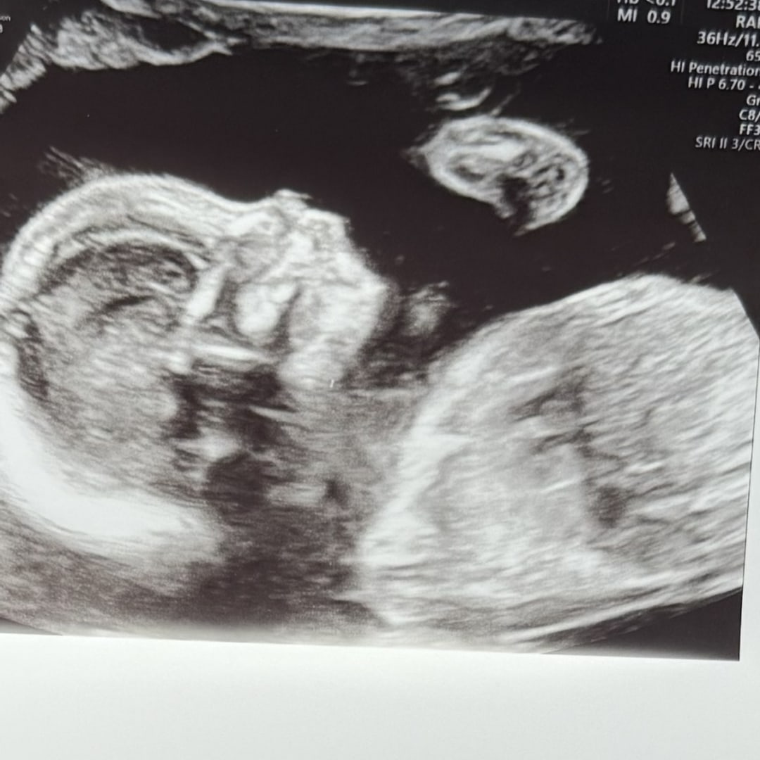 Photo shared by Maggie for their Babylist baby registry.