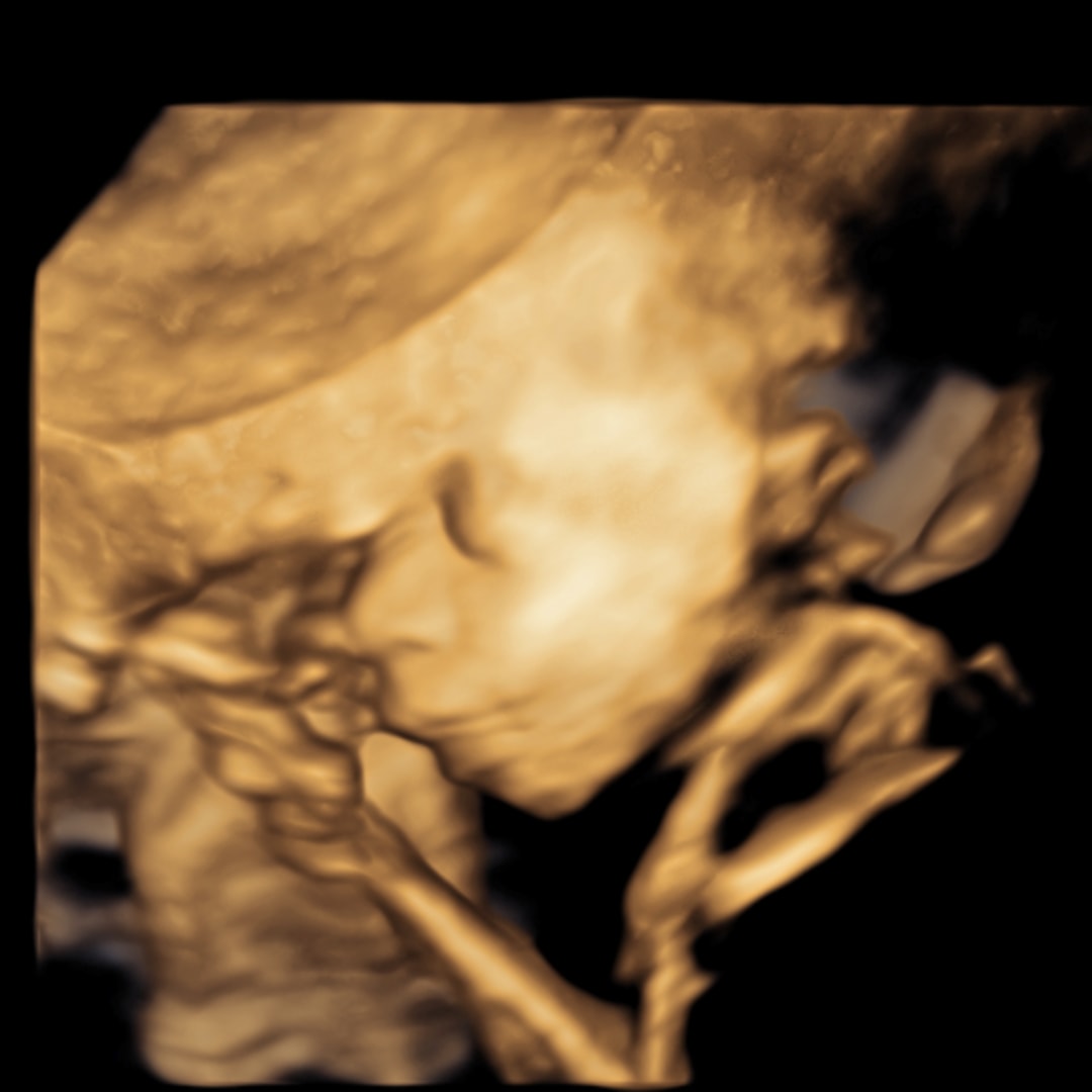 Photo shared by Lisette for their Babylist baby registry.