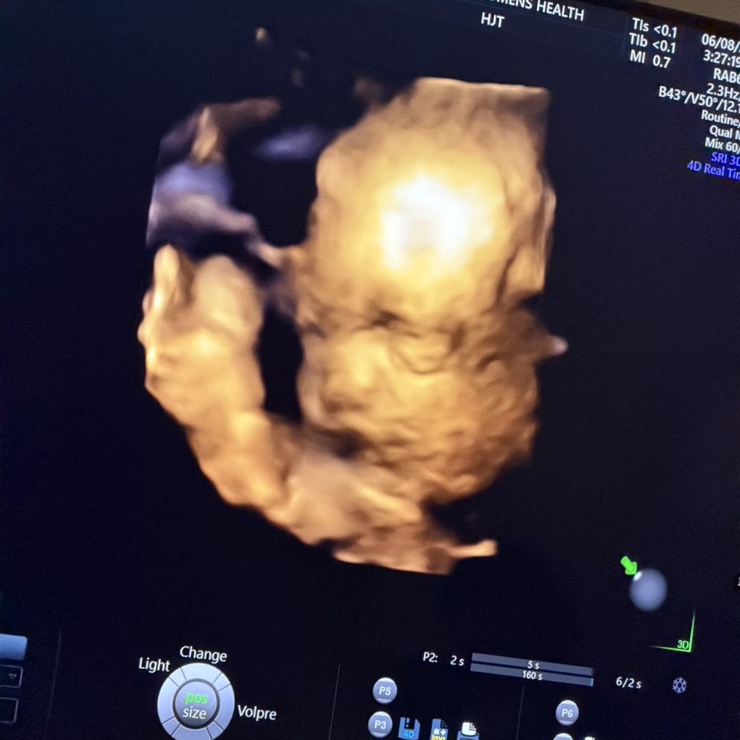 Photo shared by Chris for their Babylist baby registry.