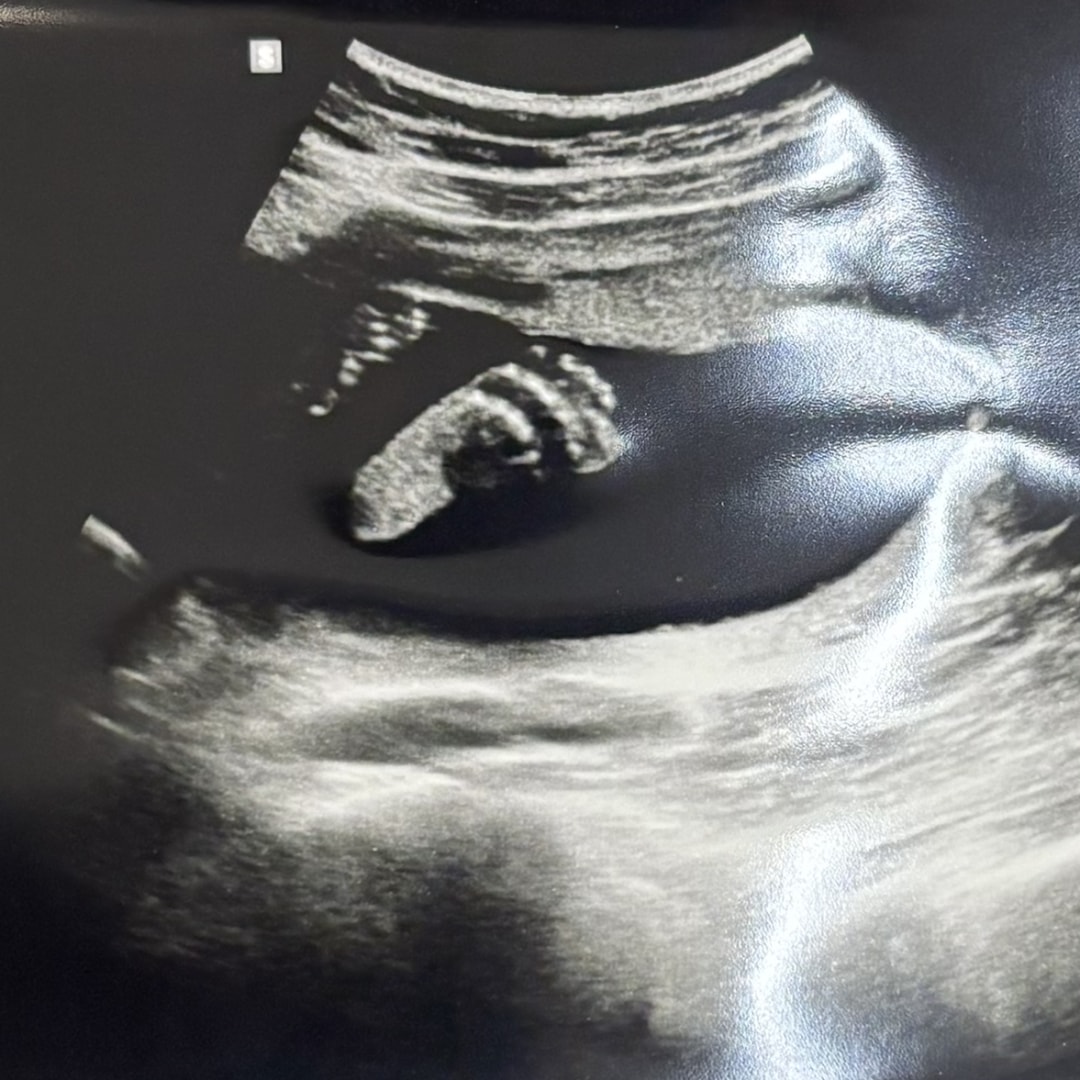 Photo shared by Abigail for their Babylist baby registry.