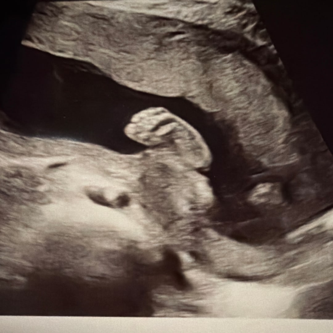 Photo shared by Melanie for their Babylist baby registry.