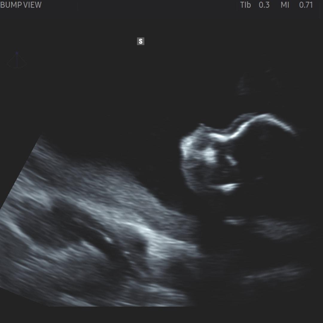 Photo shared by Isabella for their Babylist baby registry.