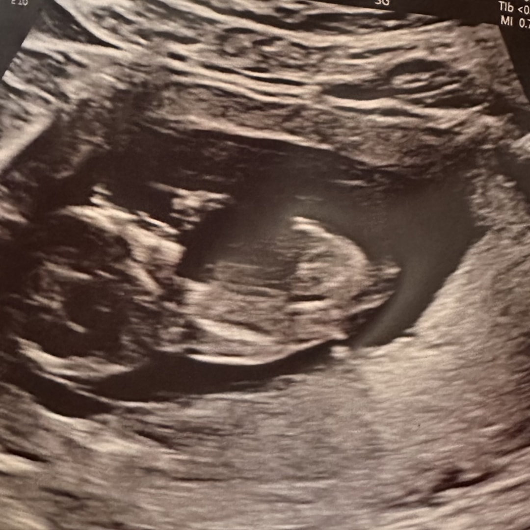 Photo shared by Desiree for their Babylist baby registry.