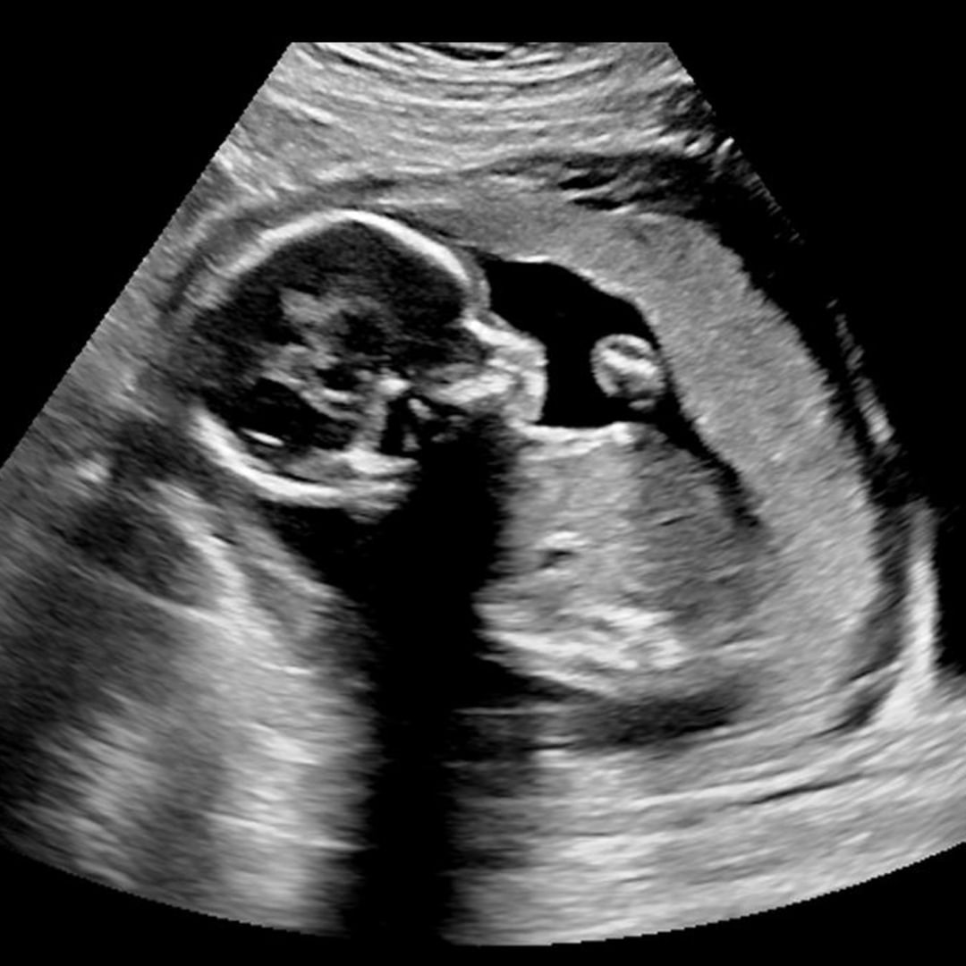 Photo shared by Roxanne for their Babylist baby registry.