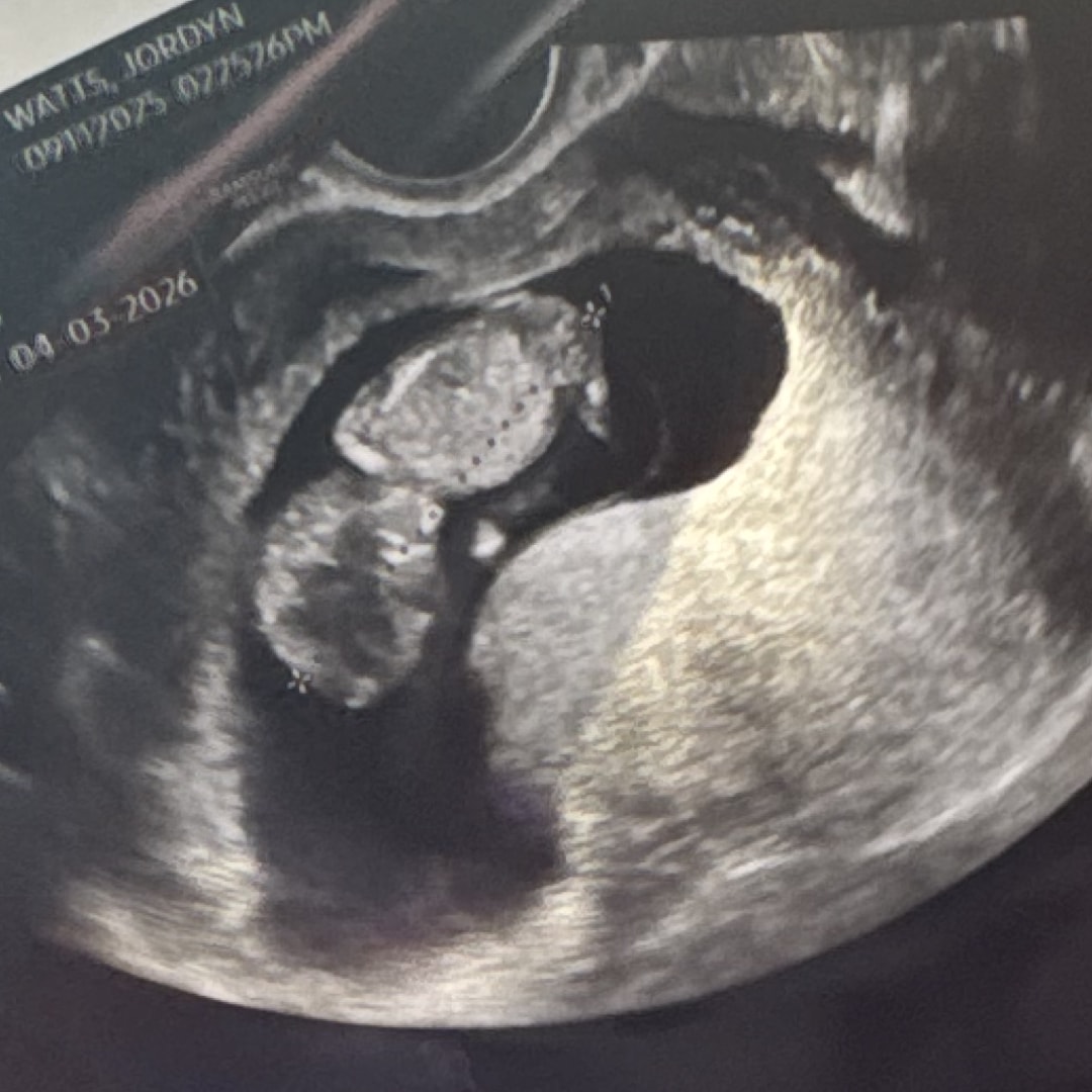 Photo shared by Jordyn for their Babylist baby registry.