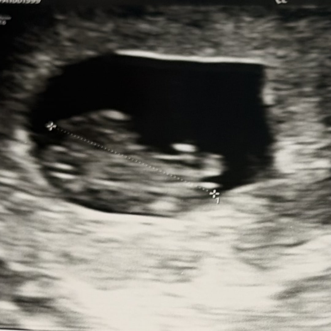 Photo shared by Amy for their Babylist baby registry.