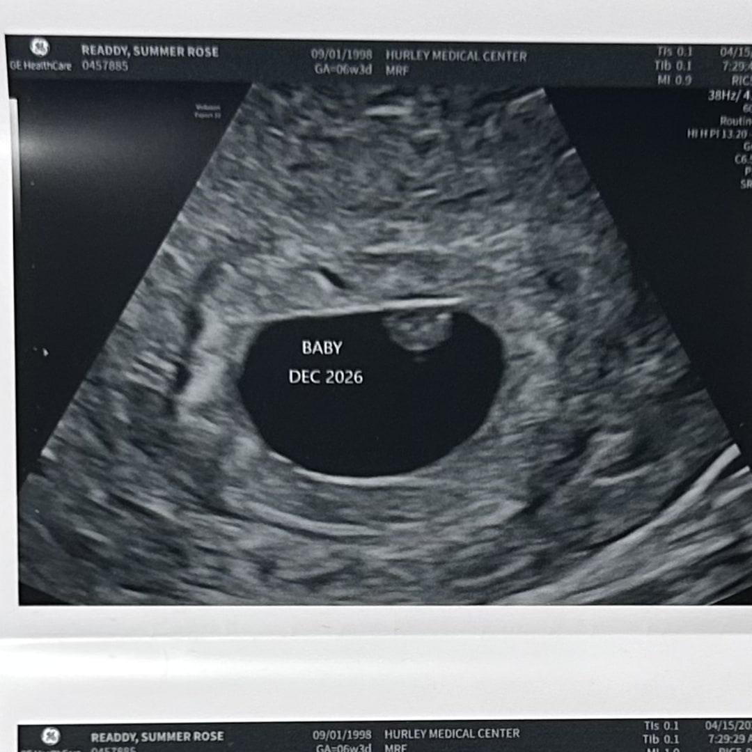 Photo shared by Summer for their Babylist baby registry.