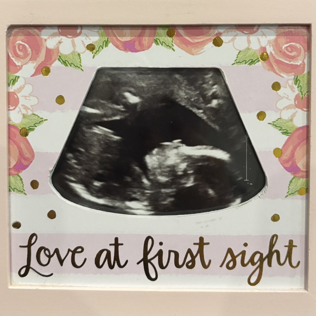 Photo shared by Amanda for their Babylist baby registry.