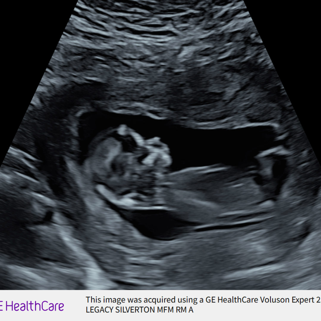 Photo shared by Nicole for their Babylist baby registry.