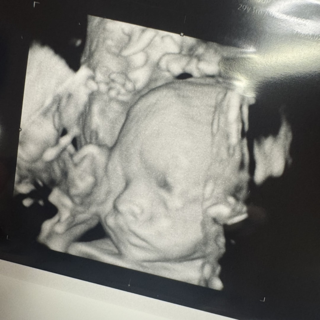Photo shared by Jenna for their Babylist baby registry.