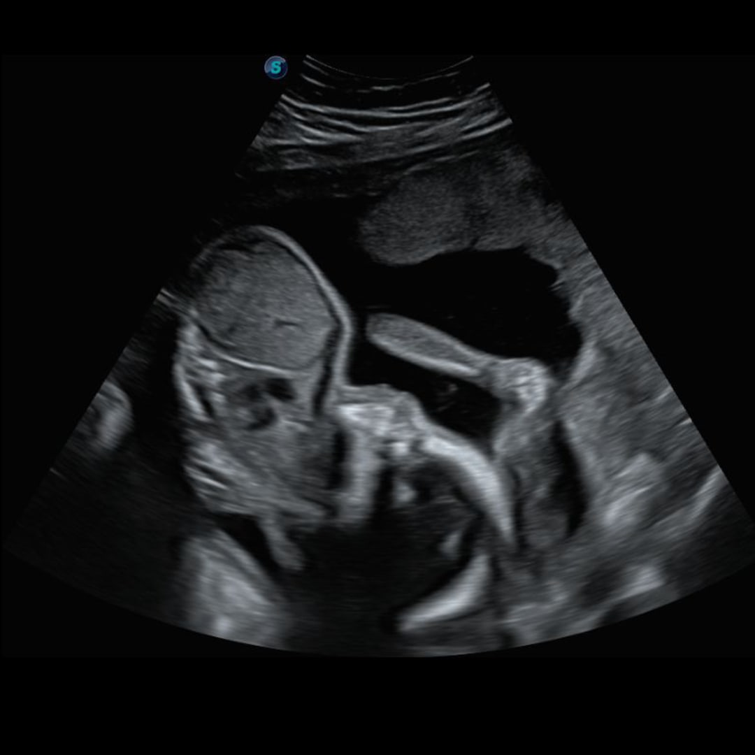 Photo shared by Mariah for their Babylist baby registry.