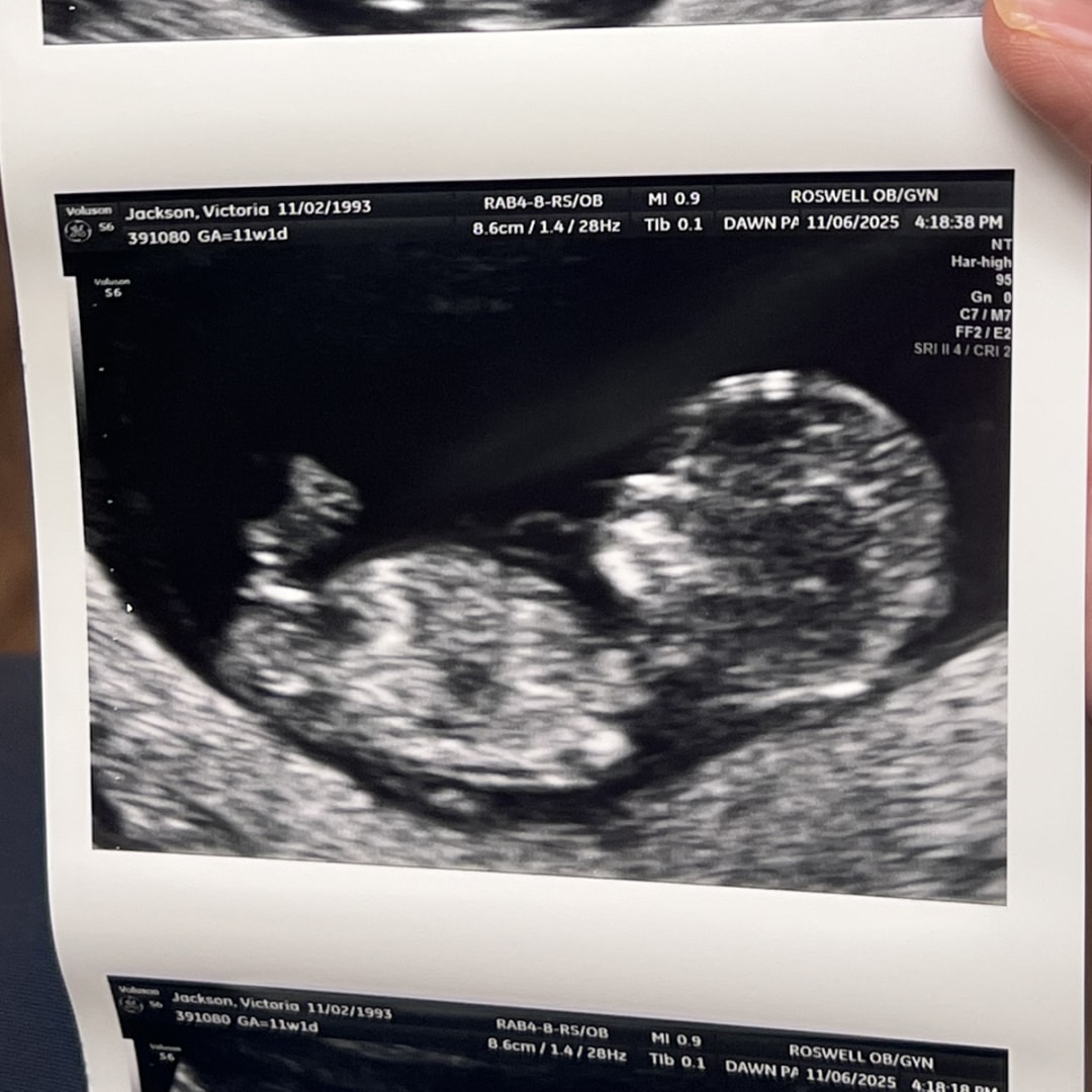 Photo shared by Victoria for their Babylist baby registry.