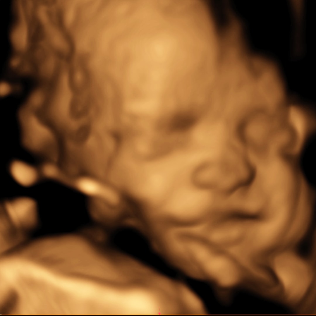 Photo shared by Alexis for their Babylist baby registry.