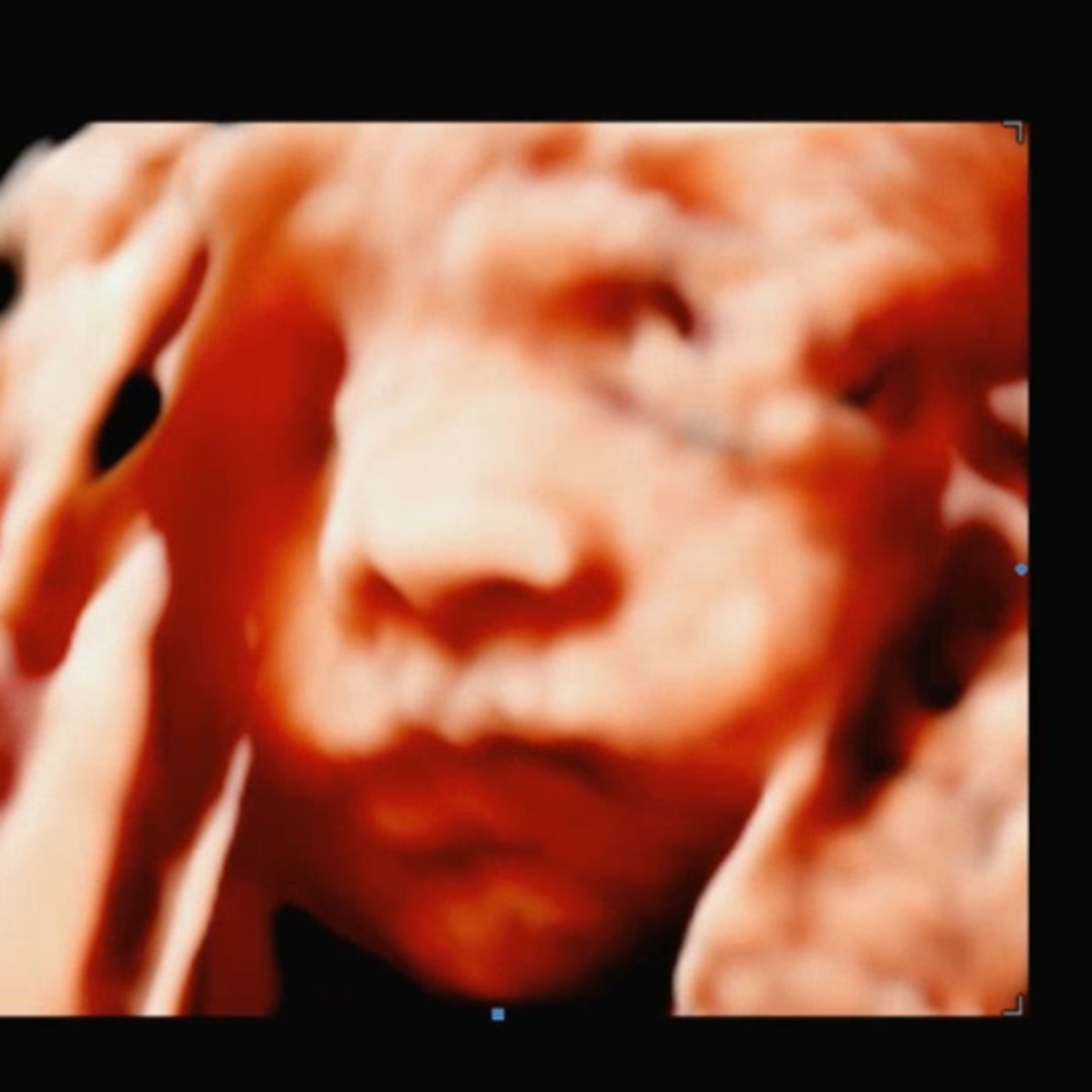 Photo shared by Chantell for their Babylist baby registry.