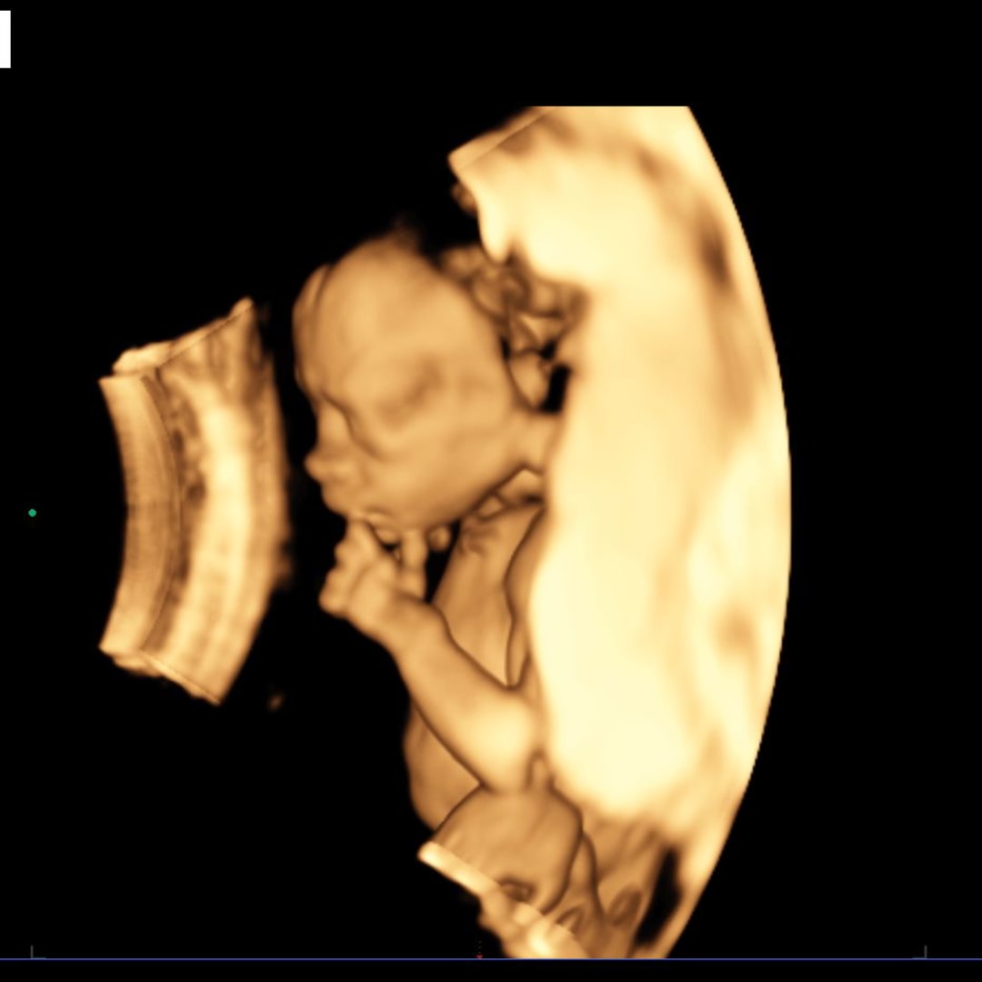 Photo shared by Atlee for their Babylist baby registry.