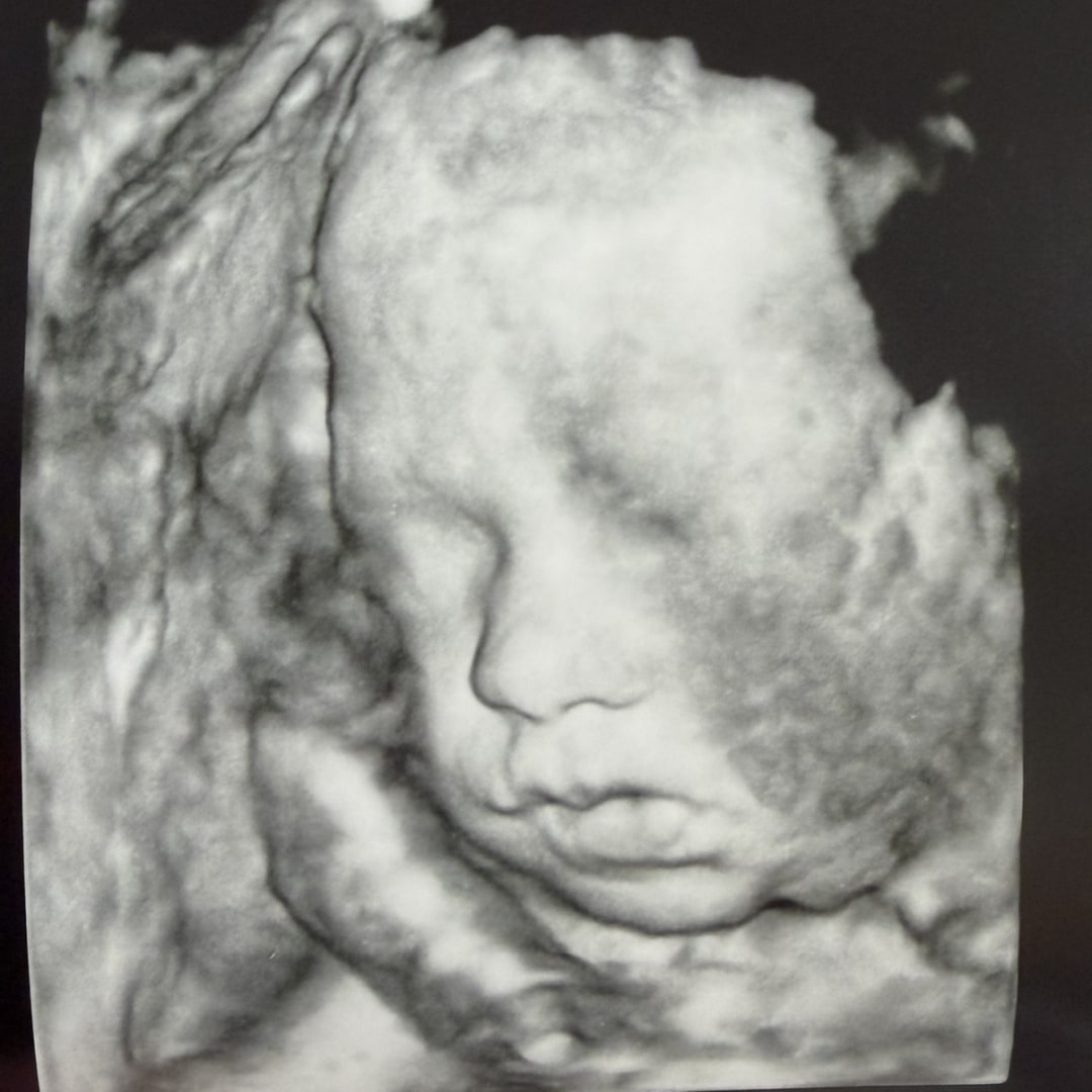 Photo shared by Brenna for their Babylist baby registry.