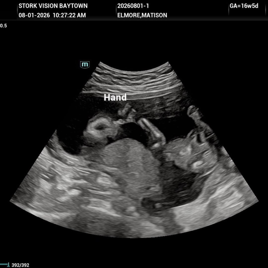 Photo shared by Mattie for their Babylist baby registry.