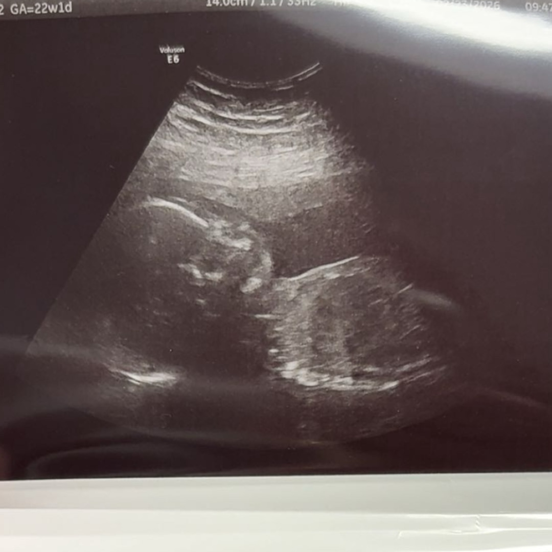 Photo shared by Autumn for their Babylist baby registry.