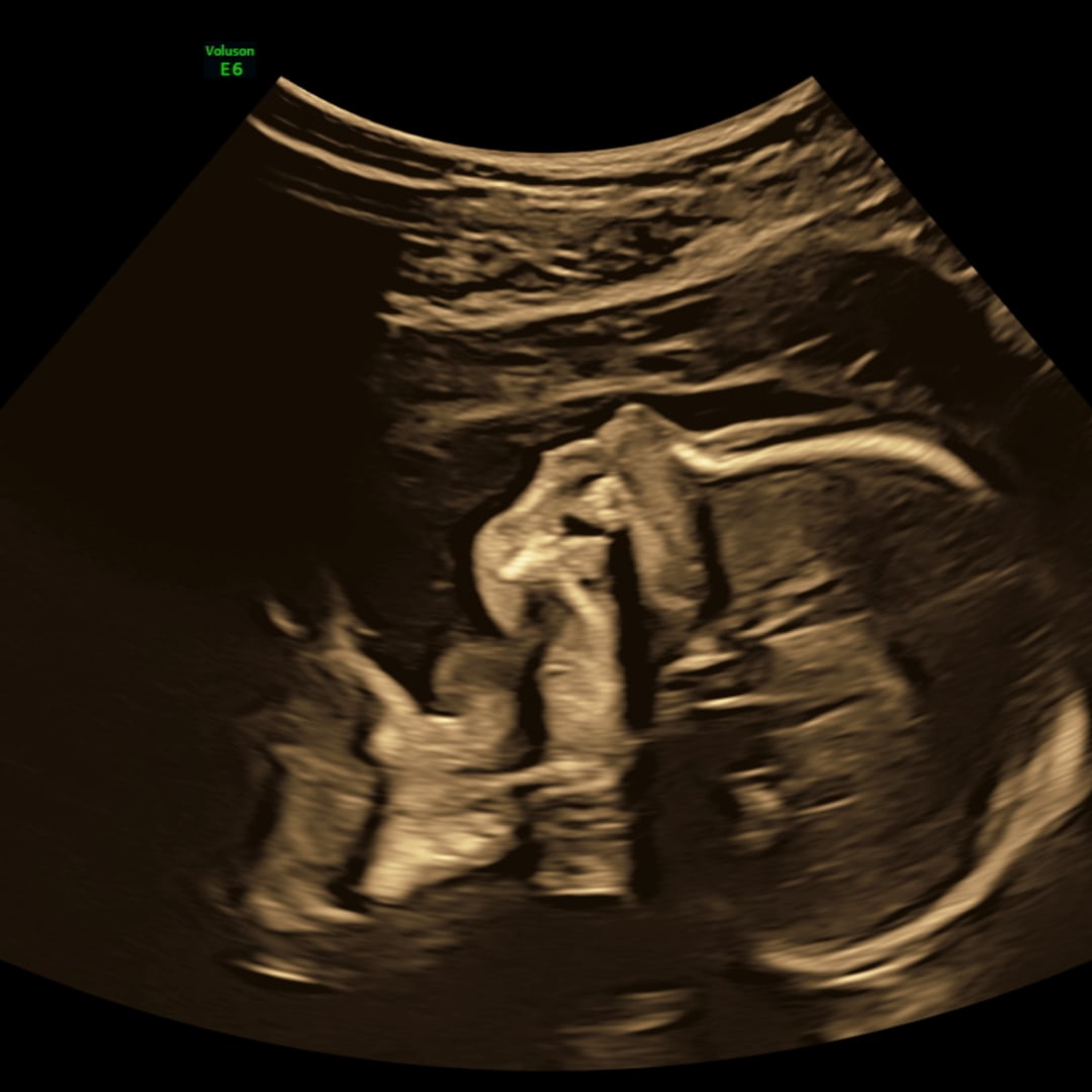 Photo shared by Emily for their Babylist baby registry.
