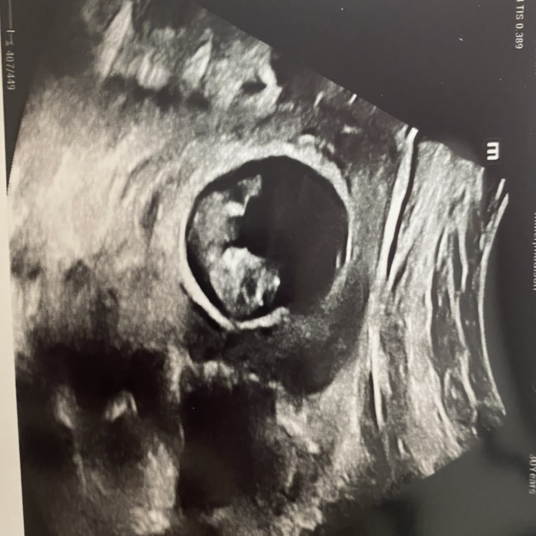 Photo shared by Madison for their Babylist baby registry.