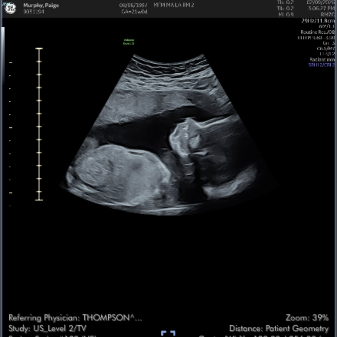 Photo shared by Paige for their Babylist baby registry.