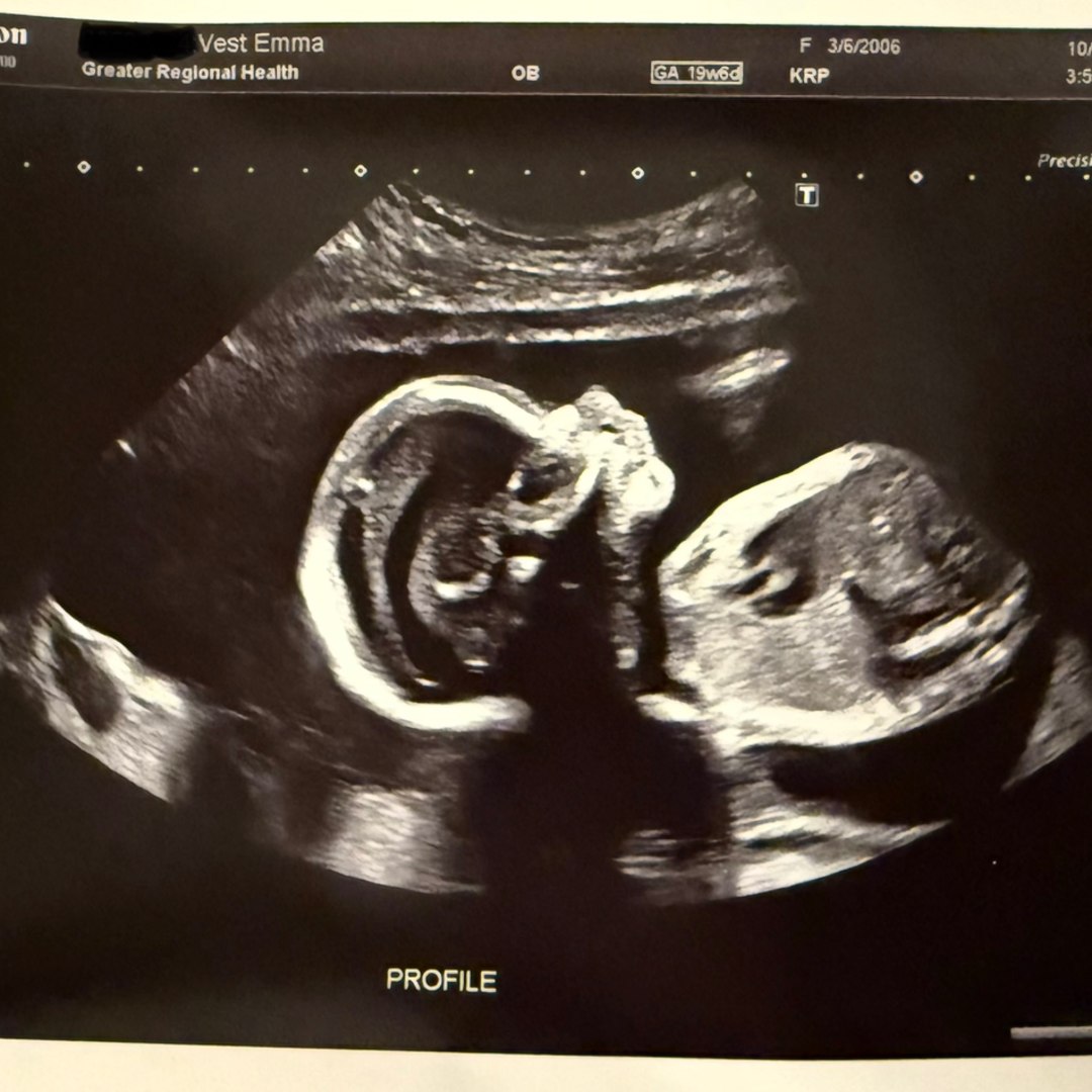 Photo shared by Emma for their Babylist baby registry.