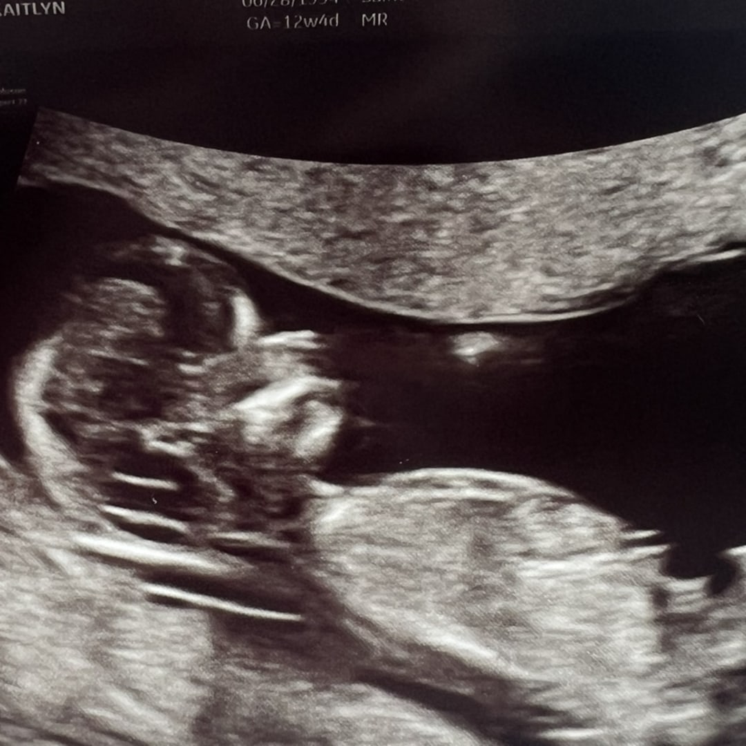 Photo shared by Kate for their Babylist baby registry.