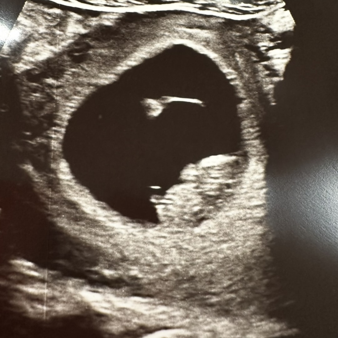 Photo shared by Hali for their Babylist baby registry.