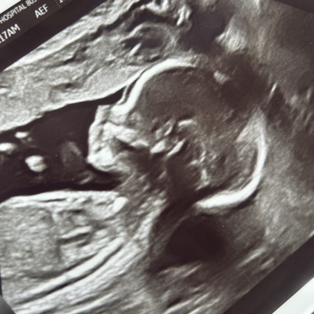 Photo shared by Maria for their Babylist baby registry.