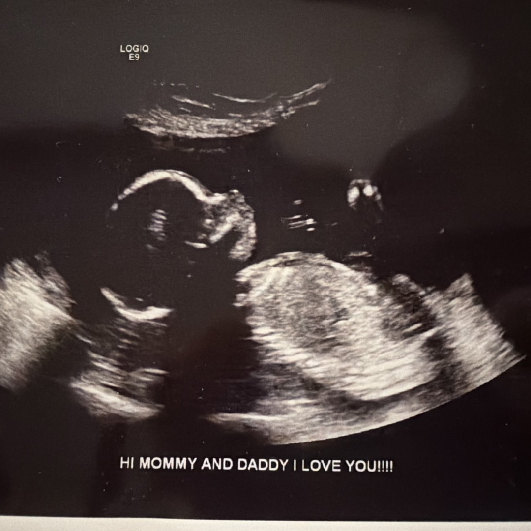 Photo shared by Allison for their Babylist baby registry.