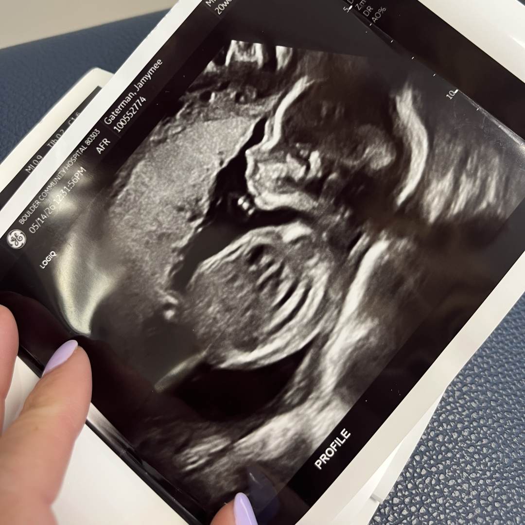 Photo shared by Jaymee for their Babylist baby registry.