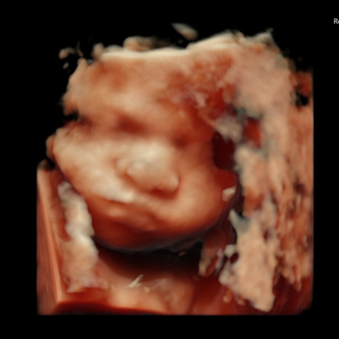 Photo shared by Esyence for their Babylist baby registry.