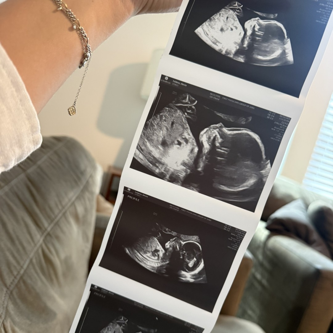 Photo shared by Alexia for their Babylist baby registry.