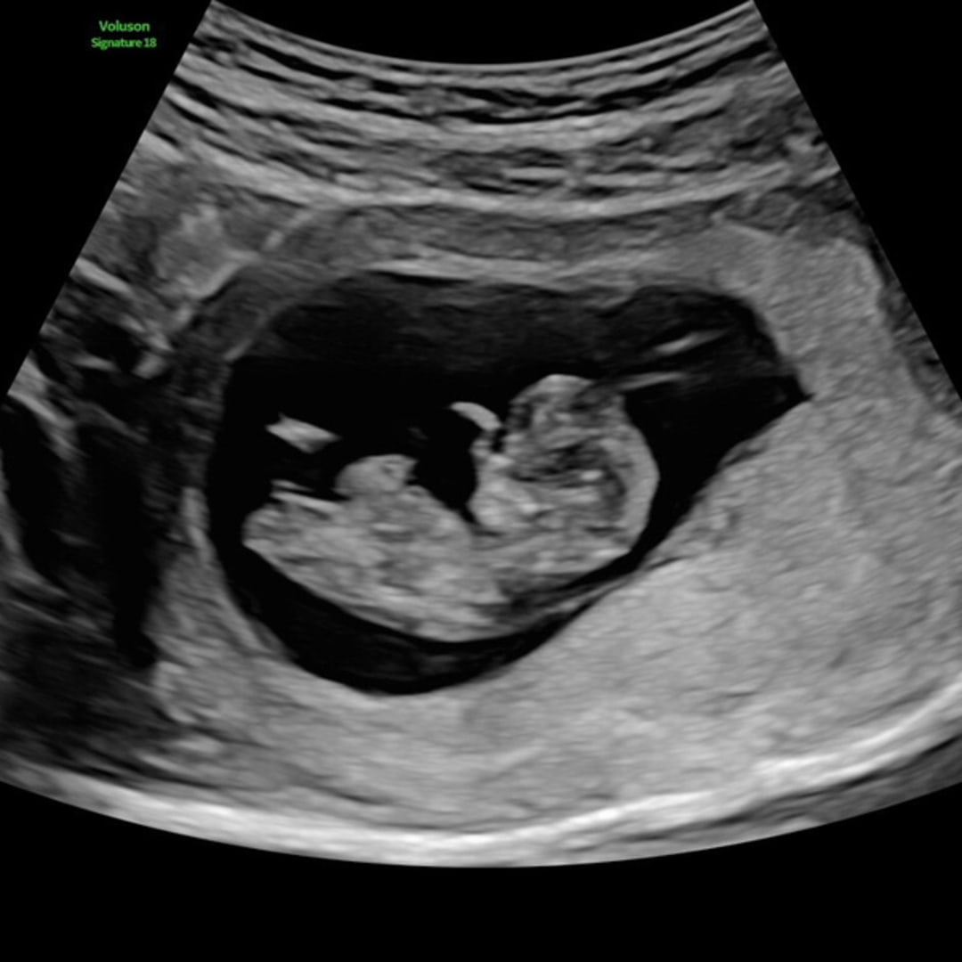 Photo shared by Madyson for their Babylist baby registry.