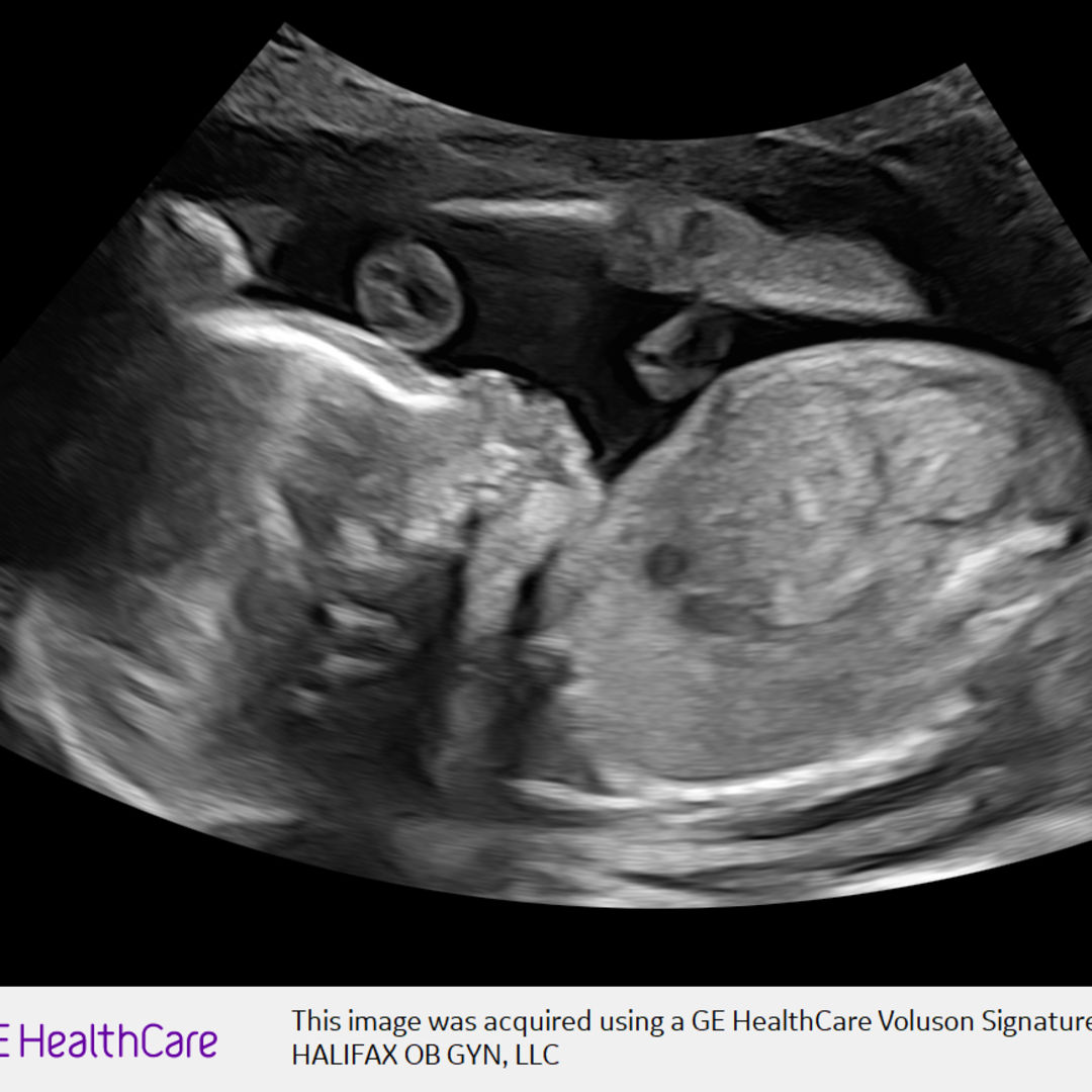 Photo shared by Christiana for their Babylist baby registry.