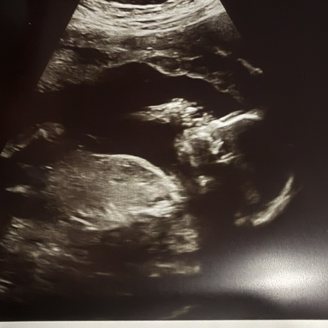 Photo shared by Ryanna for their Babylist baby registry.