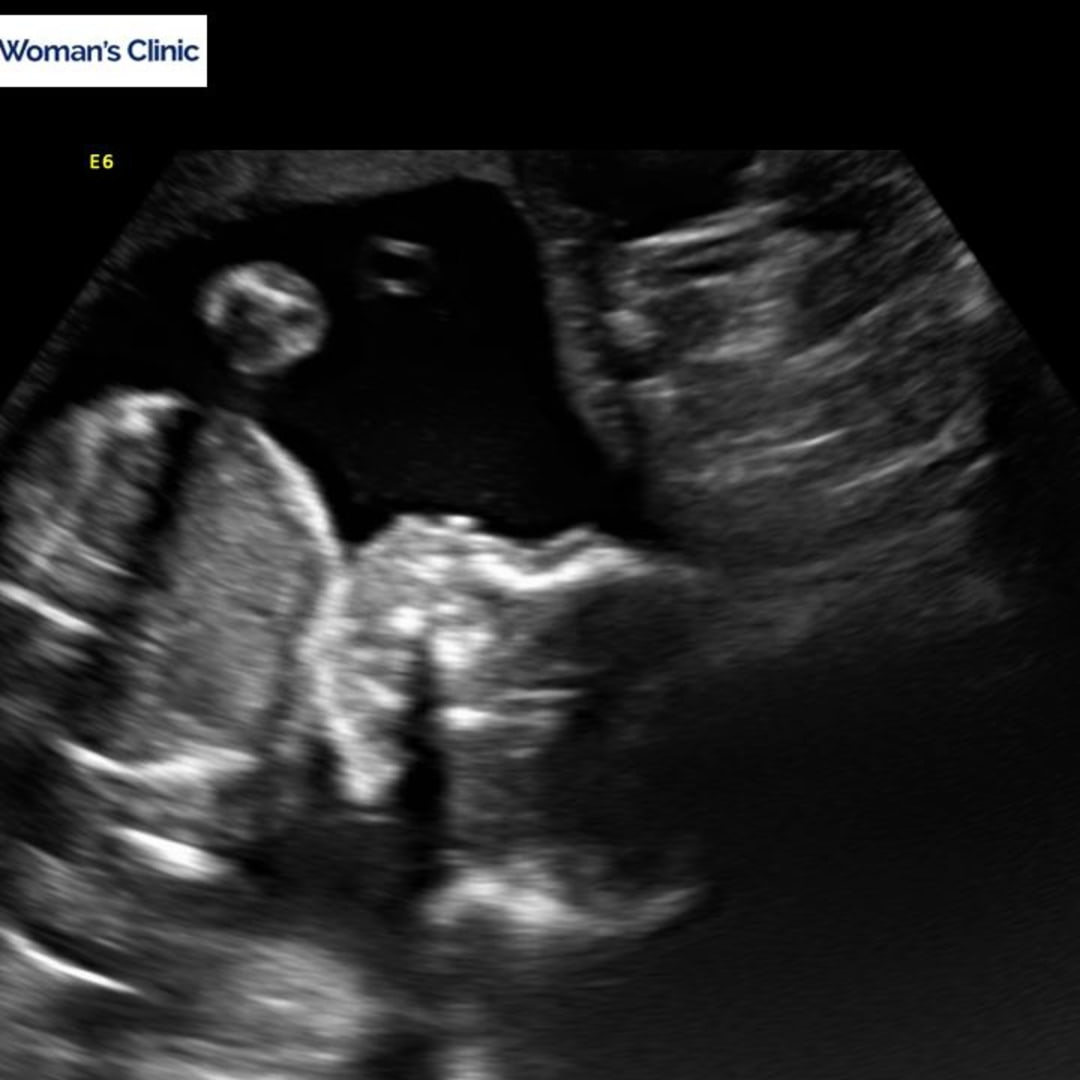 Photo shared by Mackenzie for their Babylist baby registry.