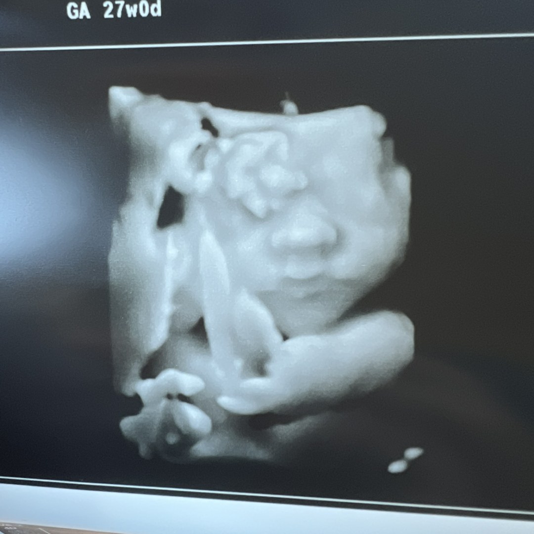 Photo shared by Cate for their Babylist baby registry.