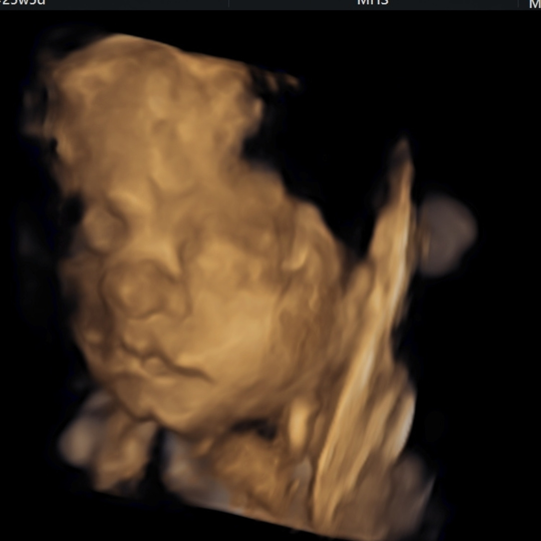 Photo shared by Stephanie for their Babylist baby registry.