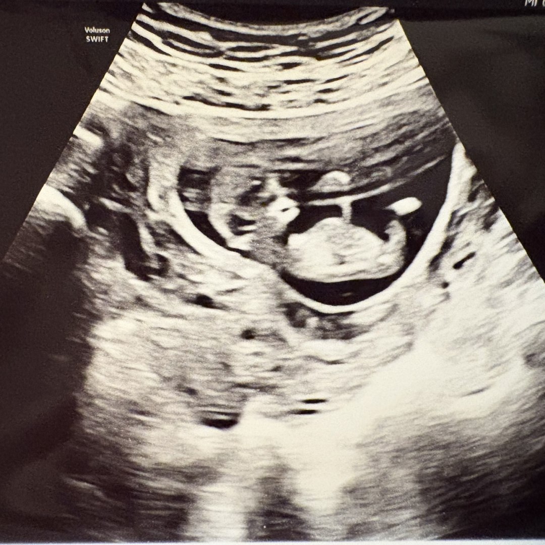 Photo shared by Dawndai for their Babylist baby registry.