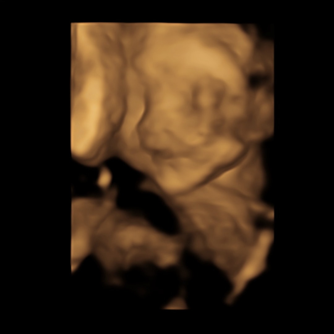 Photo shared by Napu for their Babylist baby registry.