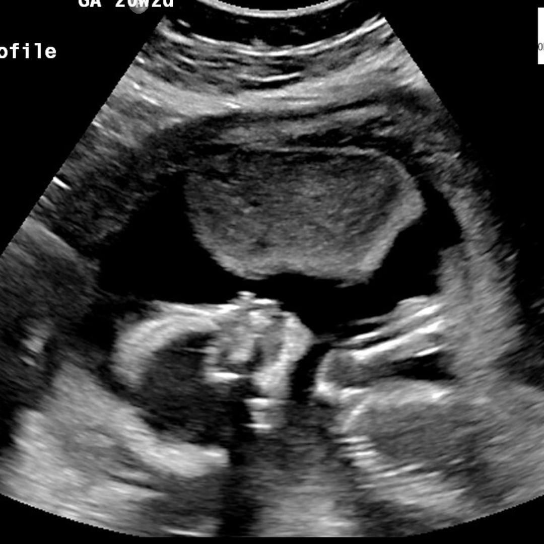 Photo shared by Brianna for their Babylist baby registry.