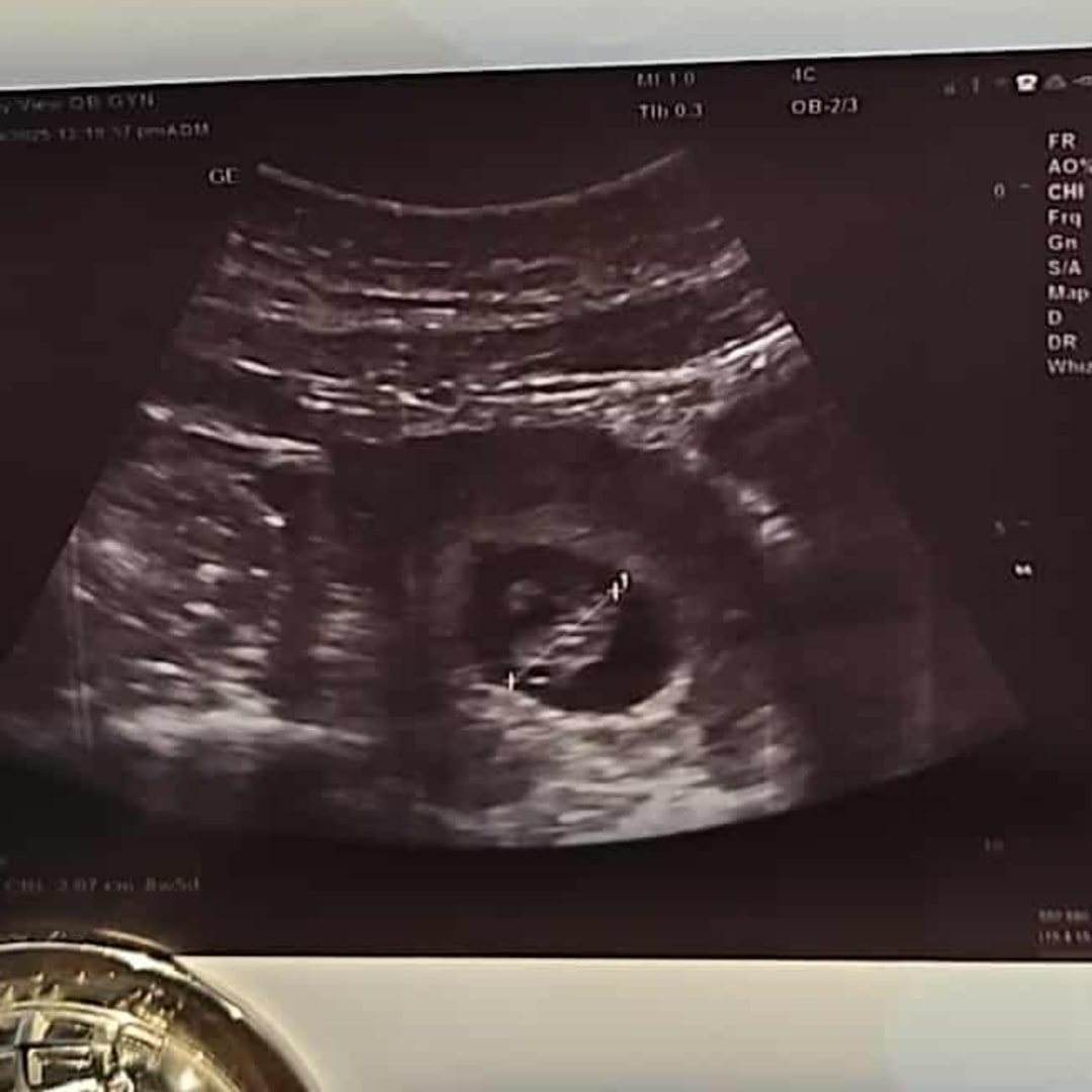 Photo shared by Kaitlyn for their Babylist baby registry.