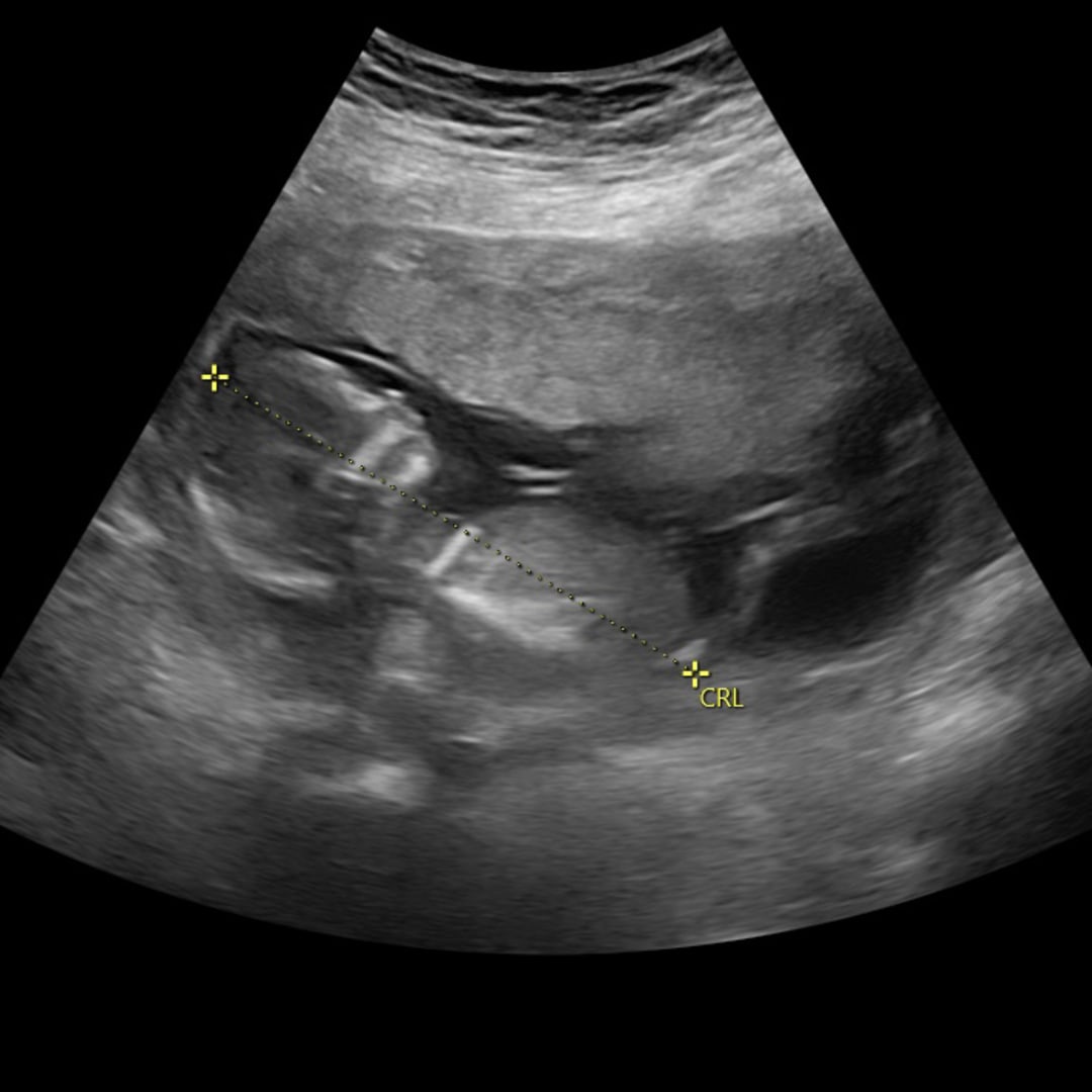 Photo shared by Emily for their Babylist baby registry.