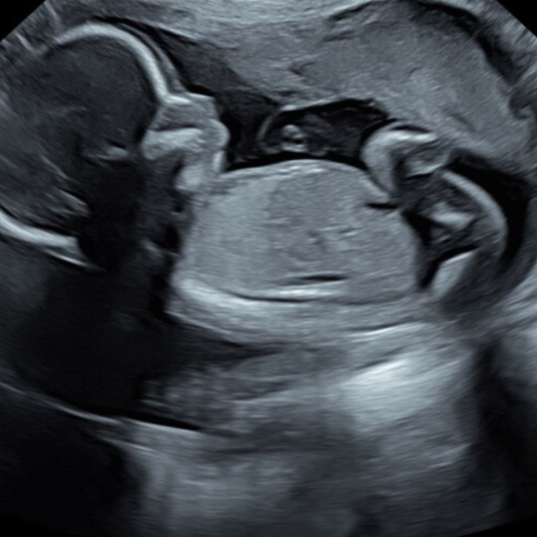 Photo shared by Angie for their Babylist baby registry.